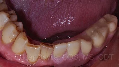 Tampa Bay Dental Studio - Tampa Advanced Dental Solutions | Tampa FL