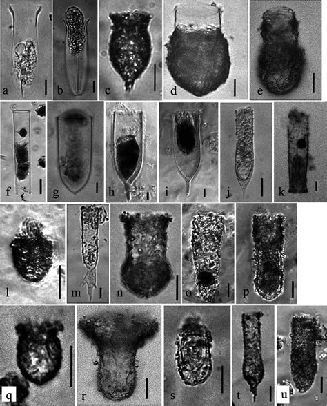 light microscope images  tintinnid species photographed