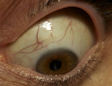 Are Parasites Visible To The Human Eye at Chris Moody blog