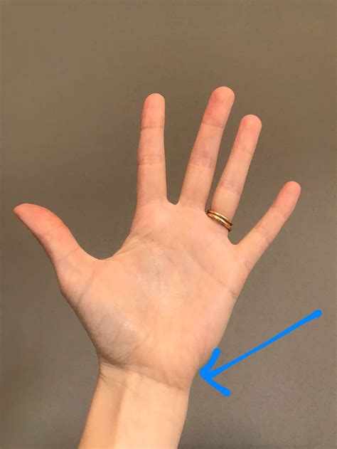 TFCC & Ulnar-side wrist injuries — Rayner & Smale