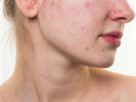 health tips  hindi bimari ka sanket kaise deta hai chehra