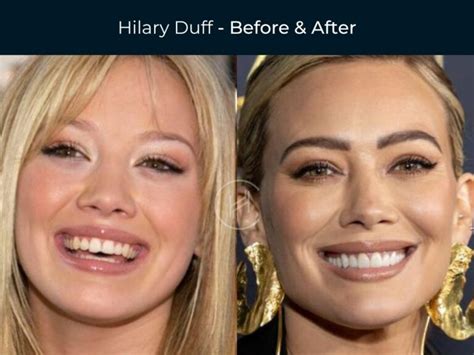Hottest Women Celebrity's Shocking Transformation: Before & After Pics - 5c98y8v