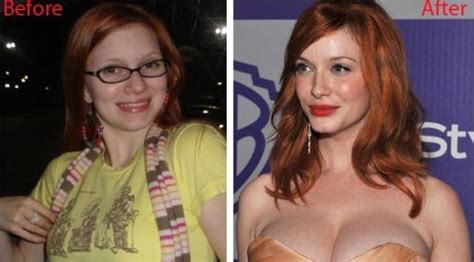 Christina Hendricks Plastic Surgery- Deciphering The Myth