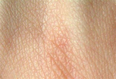 Skin