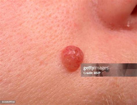 103 Mole On Cheek Stock Photos, High-Res Pictures, and Images - Getty ...