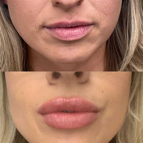 Results | BC Cosmetics