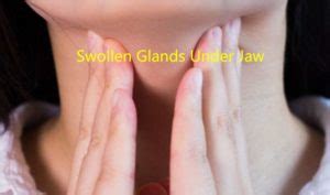 Swollen Glands Under Jaw: Causes and Home Remedies