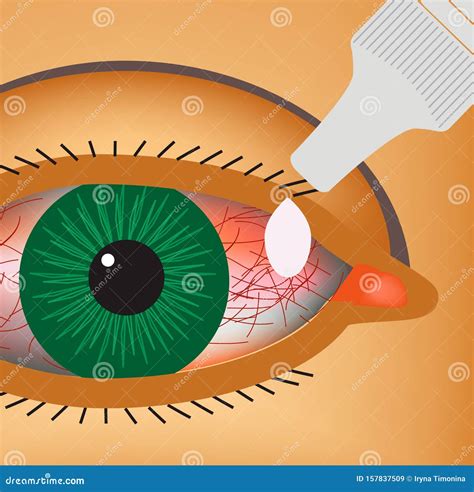 Pink Eye Inflammation