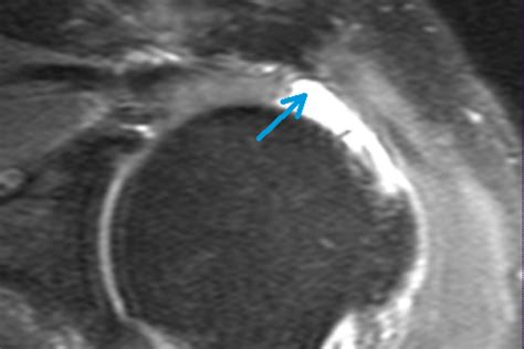 Schulter – Dietrich-Bonhoeffer-Klinikum