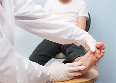 La verruca: vediamo insieme cos’è - F-Medical Group