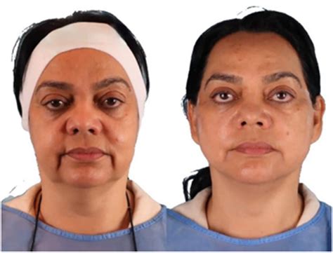 procedure  scientific diagram