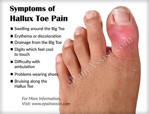 big toe tenderness touch   toe pain  treatment options