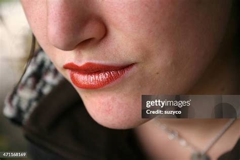 363 Face Dermatitis Stock Photos, High-Res Pictures, and Images - Getty ...