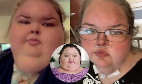 1000 Lb Sisters: Tammy Looks Smaller Than Amy After Weight Loss Surgery!