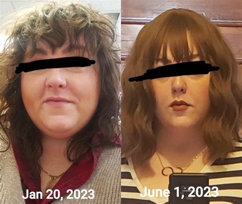Forum Candid: Before & After Photos Will SHOCK You! Image 2