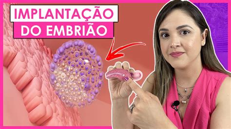 Sintomas Da Implantação Do Embrião - SINTOMAS DA IMPLANTAÇÃO DO EMBRIÃO NO ÚTERO - YouTube