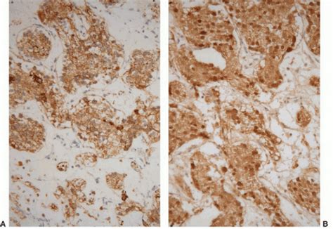 C3-FF33.gif | Abdominal Key 