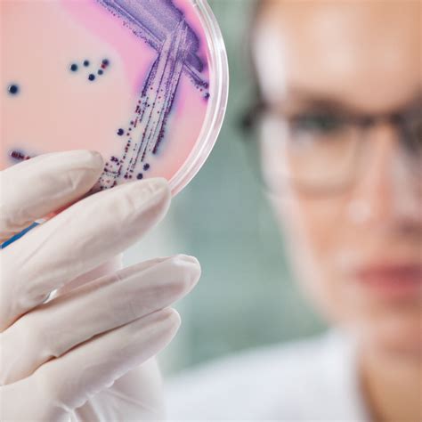 acute infection ace uk