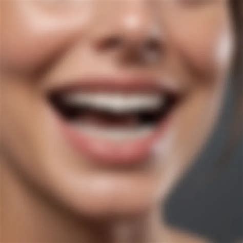 Best Teeth Bleaching Products Reviewed and Compared