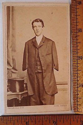 antique civil war cdv amputee  alfred stratton authentic