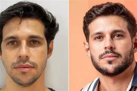 Fotos De Redesignação Sexual Antes E Depois - Após redesignação sexual, Bella Longuinho posta foto de infância ...