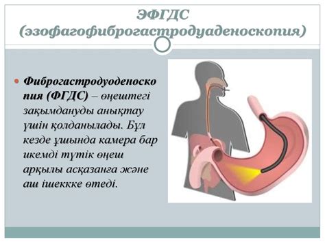 Рефлюкстік гастро-эзофагальдІ синдром - презентация онлайн