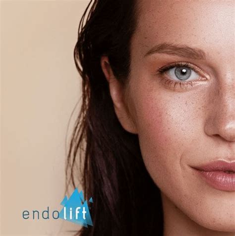 Especialista em Endolift Laser - Especialista- Lasers, Preenchimento e ...