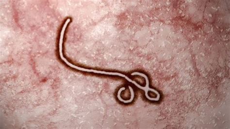 Ebola News, Articles | IFLScience