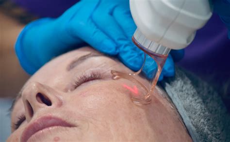 cosmetic treatment maitland cosmetic clinic hunter valley