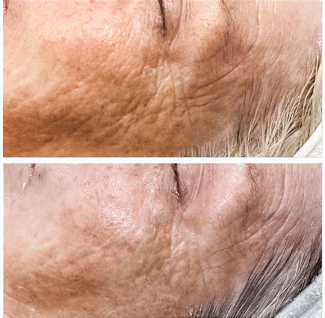 Redefine Room | Sunshine Coast QLD