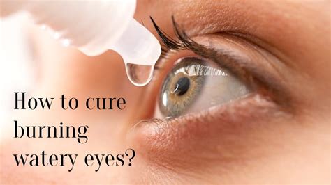 How to cure burning watery eyes? - SuccessYeti