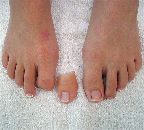 discover    missing toe tattoo latest ineteachers