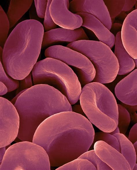 Electron Microscope Red Blood Cells Under Microscope Micropedia | My ...