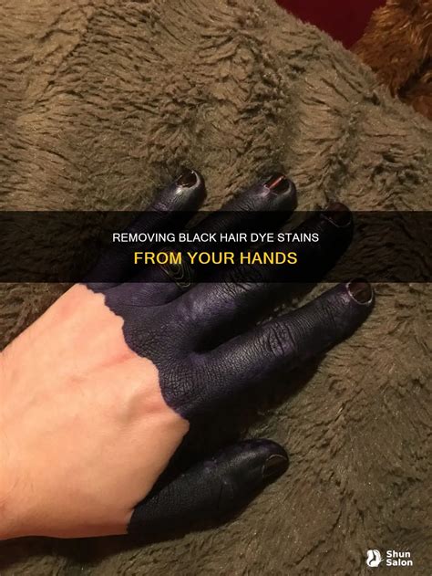 how to get rid of hair dye on hands