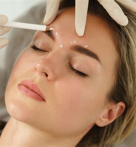 treatment fees binsina skin laser clinic