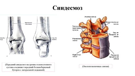 Соединение костей - презентация онлайн