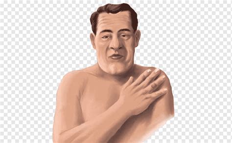 acromegaly disease gigantism pituitary gland hormone acromegaly face