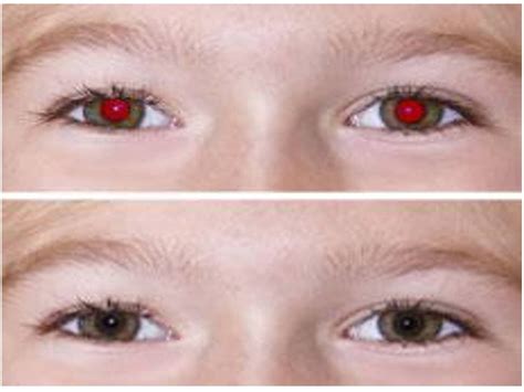 Como Remover Olhos Vermelhos de Fotos no PC, Celular e Online