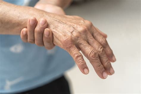 What Is Neuropathic Arthritis?