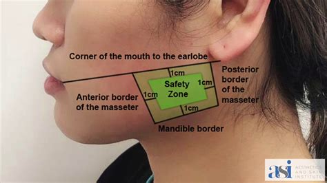 masseter youtube