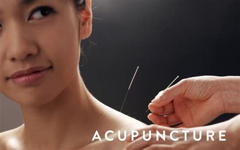acupuncture   registered acupuncturist toronto physiotherapy