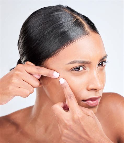 Unbelievable Blackhead Removal 2024: Celebrity Dermatologist Shares Her Secrets. Image 8
