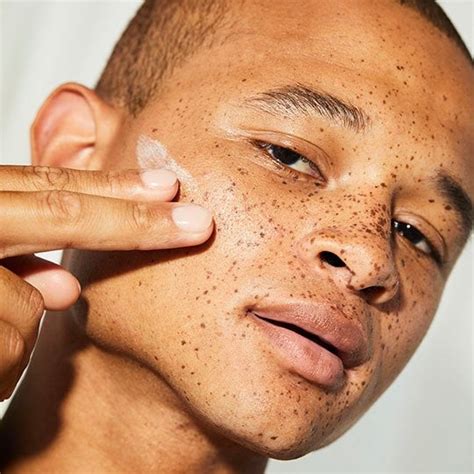 Dry Skin on Forehead: Causes and How to Prevent It | Skincare.com