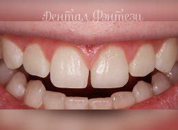 Стоматология для детей в Москве - Dental Fantasy