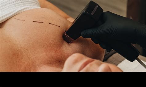 Treatments You Should Avoid During the Summer Months – Boutique Skin Envie