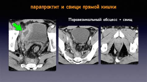 Визуализация прямой кишки и перианальной области