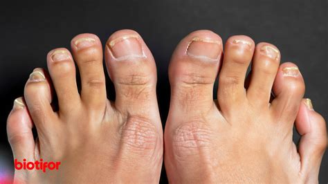 fungsi tulang jari kaki kesehatan  keseimbangan tubuh biotifor