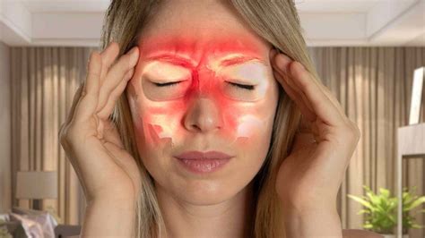 Acute Sinus Headache: Symptoms, Treatment, and Prevention – Headachecap ...