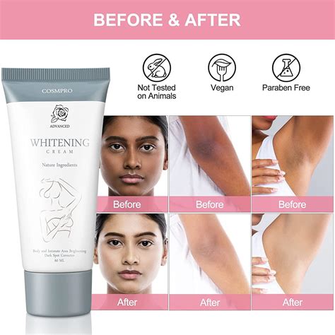 Natural Skin Bleaching Cream for Black Skin | Intimate Lightening for