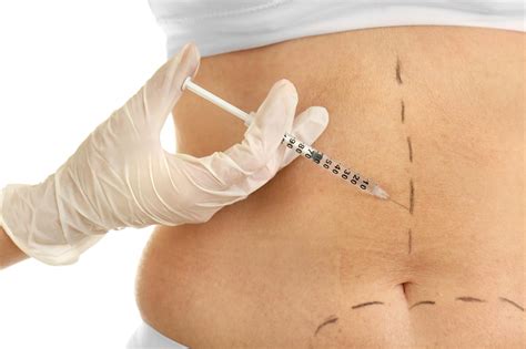 Como Aplicar Injeção Na Barriga - Injeção de barriga para correção da forma do corpo | Foto Premium